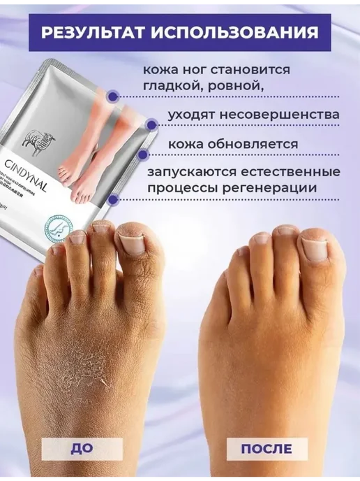 Маска для ног отшелушивающие, носочки, белый, фото 4