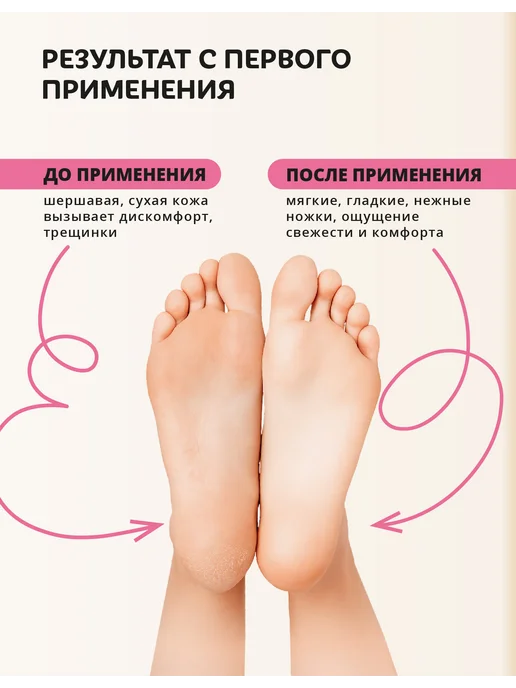 Monty Маска носочки для ног увлажняющая, питательная, 3 пары, белый, фото 5