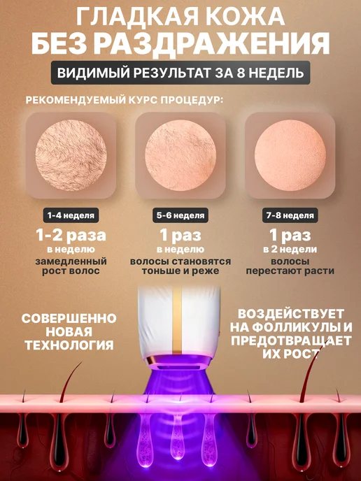 YOUGMEE Фотоэпилятор лазерный для удаления волос женский, вариант, фото 5
