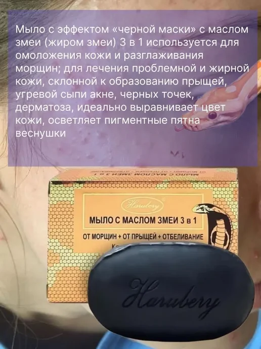 Beauty Box Набор косметики подарочный бьюти бокс уход для лица прыщей, вариант, фото 2