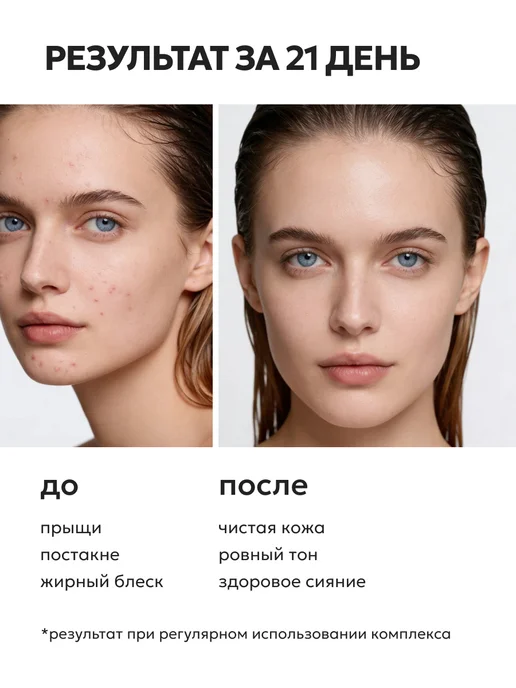 Likato professional Пенка для умывания лица от прыщей с ниацинамидом, 150 мл, фото 3