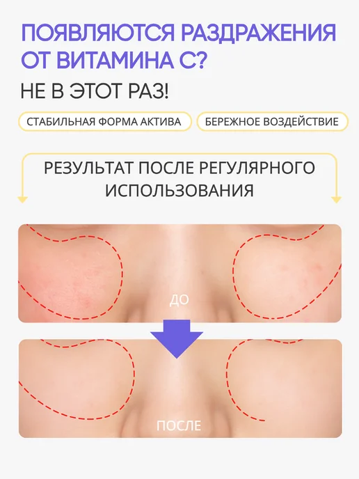 Sungboon Editor Тонер пэды диски для лица Корея осветляющие с витамином С, 60 шт, фото 3