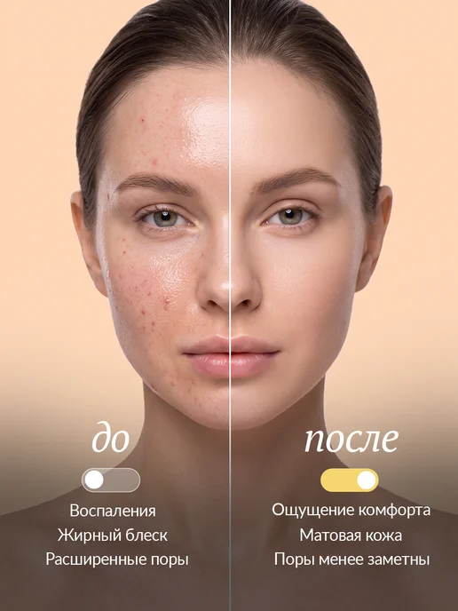 ARAVIA Laboratories Гель для умывания матирующий с салициловой кислотой и цинком, вариант, фото 2