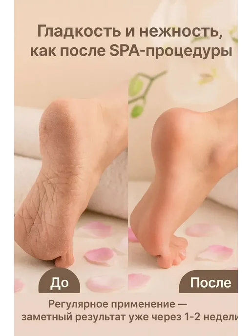 нарциссшоп Гелевые носочки для ухода за стопами, вариант, фото 2