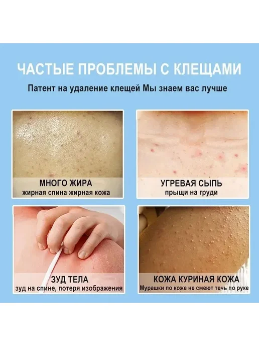 Очищающий гель для душа против прыщей, вариант, фото 3