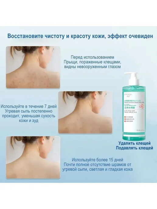 Очищающий гель для душа против прыщей, вариант, фото 7