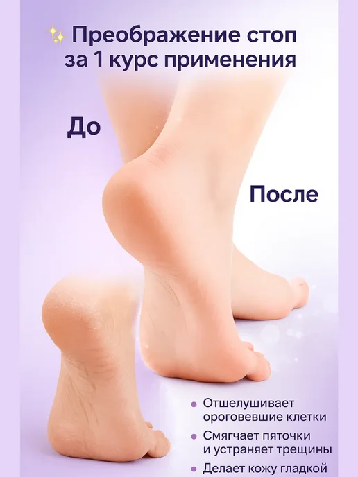 альма4 маска для ног пилинг носочки увлажняющие от трещин, белый, фото 3