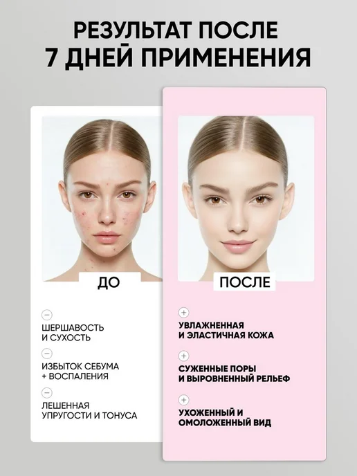 MedB Тонер-пэды для лица для глубокого очищения 70 шт, 70 шт, фото 3