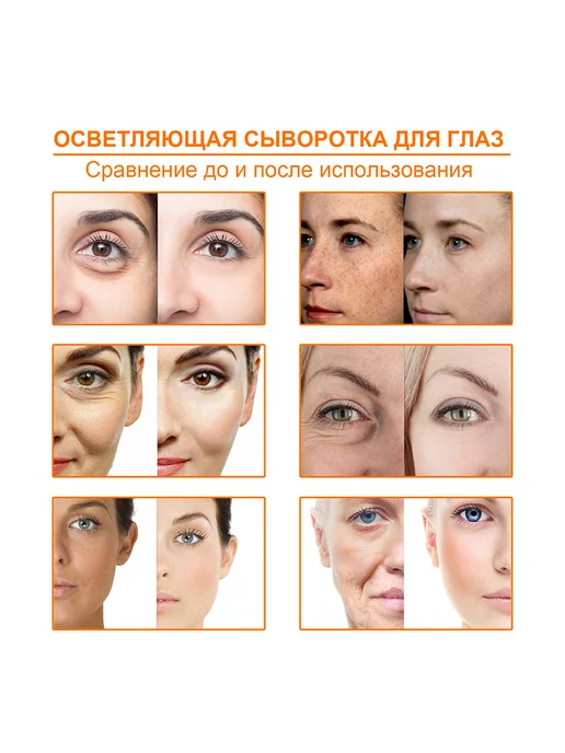 West&Month Эфирное масло лица уменьшает пигментные пятна и морщины, 10 мл, фото 6