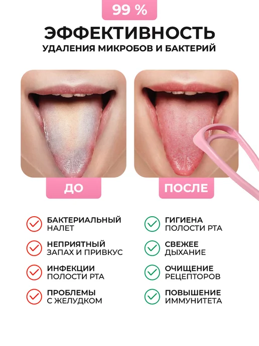 Торг Лайнс Скребок для языка от налёта взрослый детский 2 шт, 2 шт, фото 4