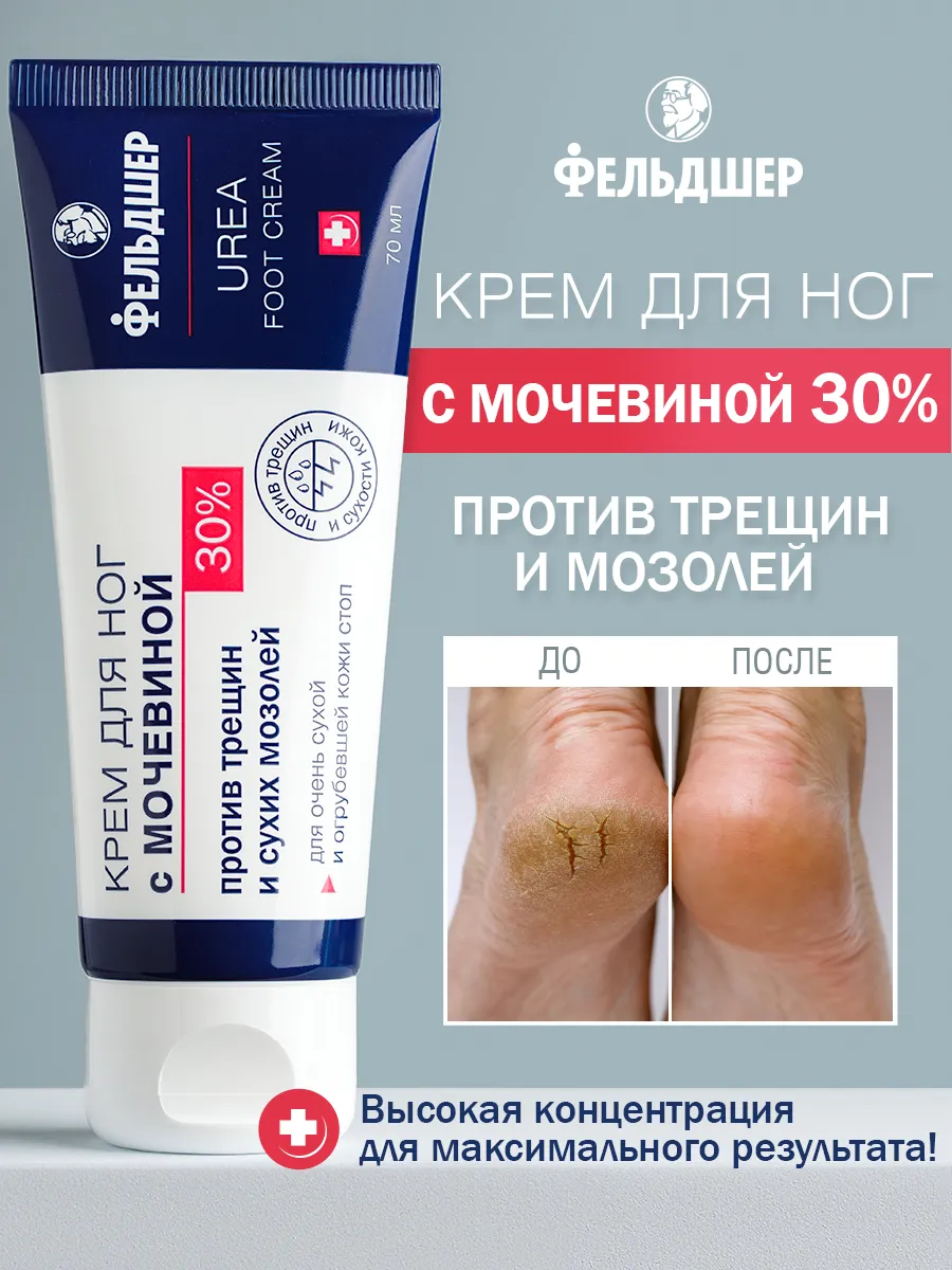 Крем для ног с мочевиной 30% от трещин и сухости