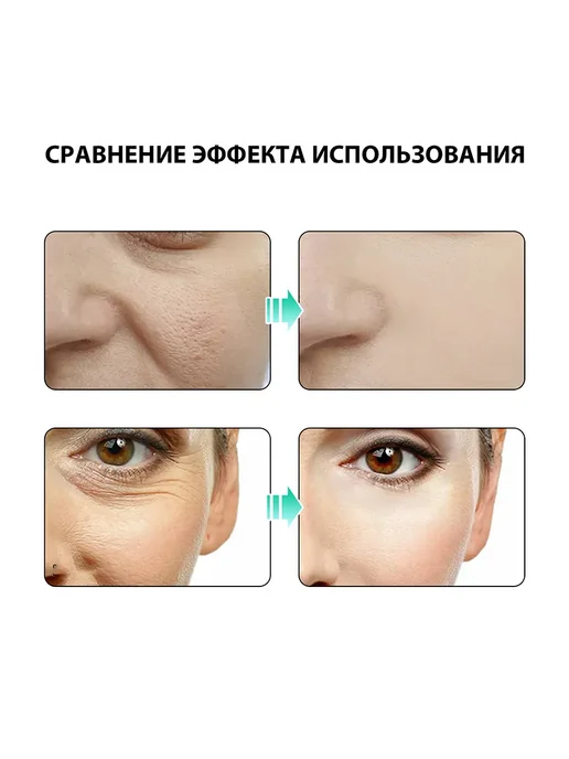Ouhoe лица Антиморщин Эфирное масло Подавляет меланина Подтяните, 30 мл, фото 8
