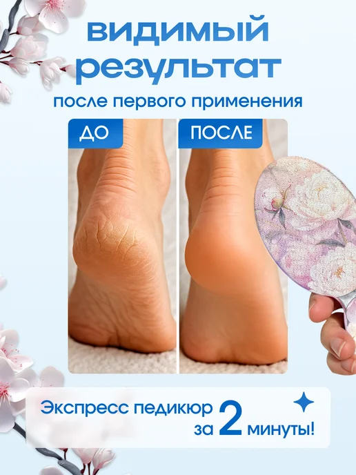 ZORUUS Профессиональная пемза для ног и пяток с ручкой нано терка, белый, фото 2